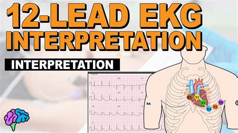 how to read ecg 12 lead test results|Introduction to 12 Lead EKG Interpretation: How to .